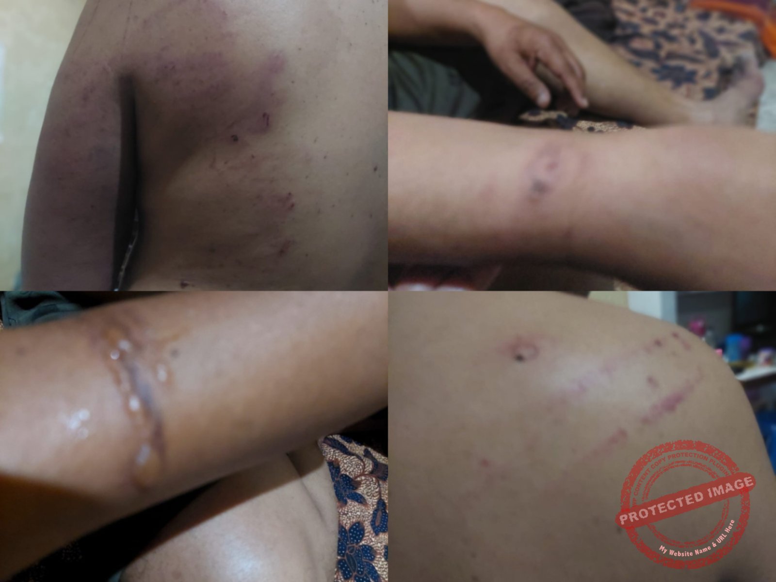 Dugaan penyekapan dan kekerasan (Dok, foto. Istimewa) 