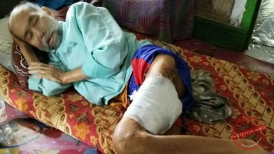 Ketua RT Ukim terbaring di rumah akibat kondisi kesehatan yang dideritanya. Ia telah mengalami luka serius pada kaki kirinya selama hampir dua tahun. (Dok, foto. Istimewa)