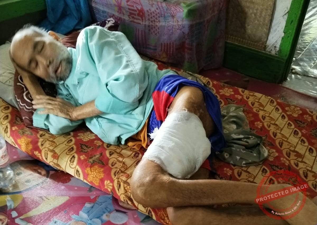 Ketua RT Ukim terbaring di rumah akibat kondisi kesehatan yang dideritanya. Ia telah mengalami luka serius pada kaki kirinya selama hampir dua tahun. (Dok, foto. Istimewa)